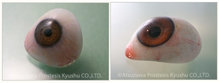 有限会社アツザワ プロテーゼ九州 製品 商品紹介 有限会社アツザワ プロテーゼ九州 製品 商品紹介